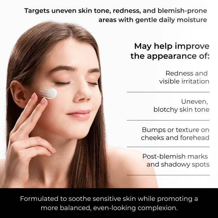 Azelaic Acid Cream